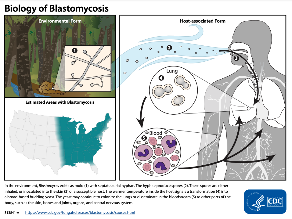 biology of blastomycosis